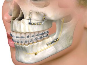 oral-maxillofacial