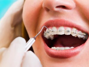 orthodontics