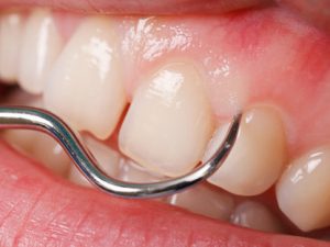 periodontics-dentistry-online